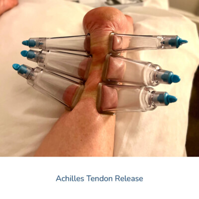 FasciaBuddySquared-Achilles-Tendon-Release-1000-400x400