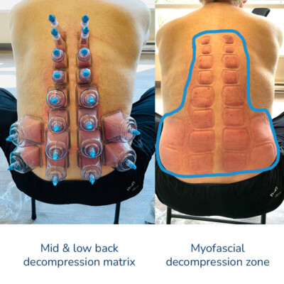 FasciaBuddySquared-Mid-Low-Back-Matrix-1000-400x400