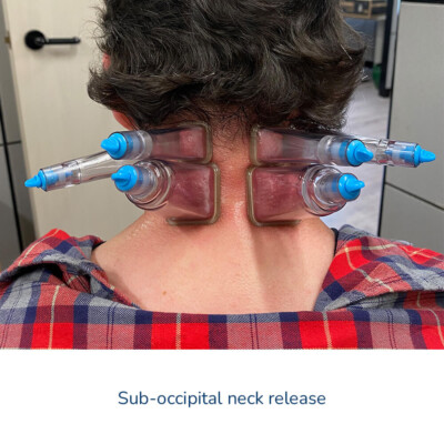 FasciaBuddySquared-Sub-Occipital-Neck-Release-1000-400x400